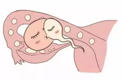 代生儿子包性别